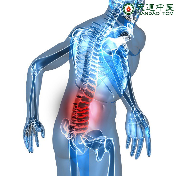 强直性脊柱炎